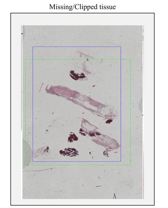 Aperio-iQC-Software_MissingTissue2