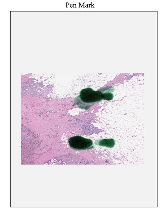 Aperio-iQC-Software_PenMark2