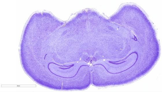 BF-mouse-brain_1-web-page