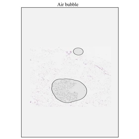 aperio-iqc-AirBubble2
