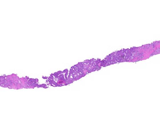 H&E stained lung tissue