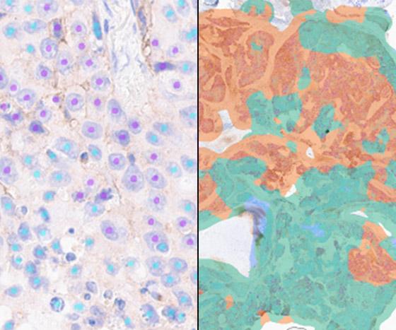 Lunit-SCOPE-PD-L1-22C3-TPS-hero