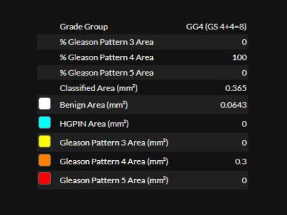 prostate-ai-carousel-img_4_560x420