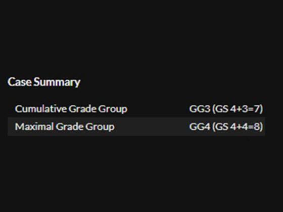 prostate-ai-carousel-img_5_560x420