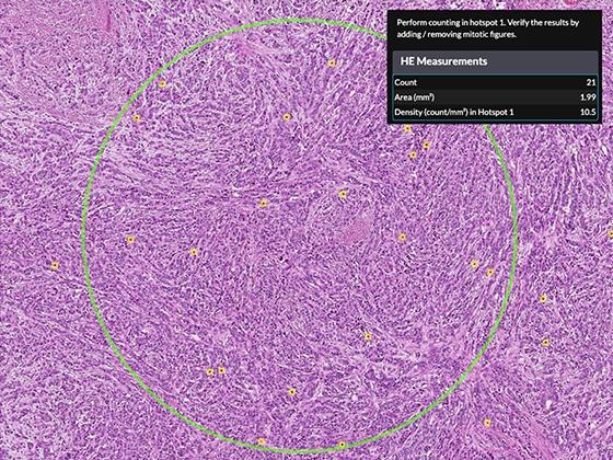 Step 2: Hotspot selection