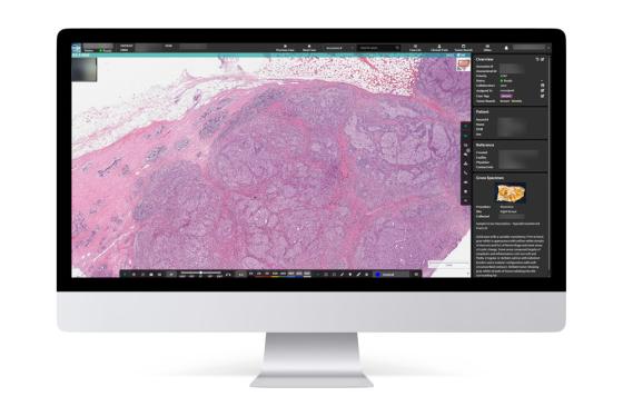 HALO-AP-Dx-Image-Management-Solution-3