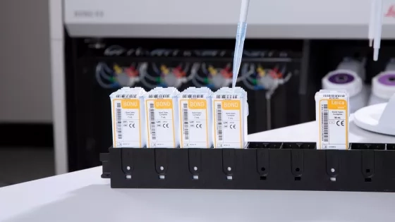 BOND RX Features Operations