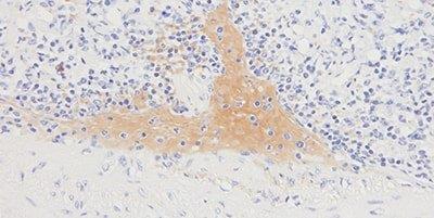Example of an immunohistochemistry stain of spleen tissue where natural peroxidase present in red cells has reacted with DAB chromogen.