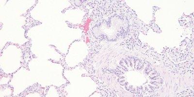 Step_61_Monitor_Eosin_pH