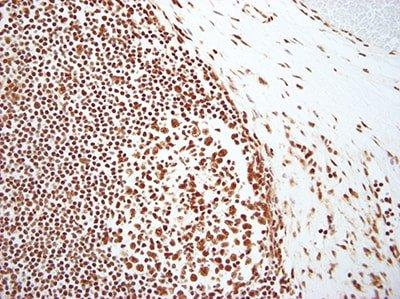 Section of tonsil stained with Poly d(T) positive control probe. The precise staining indicates that the tissue is well fixed and that RNA sequences will be well-preserved..