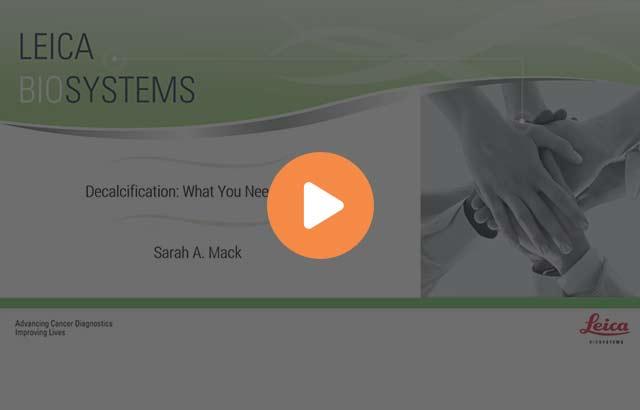 decalcification-what-you-need-to-know-640x410