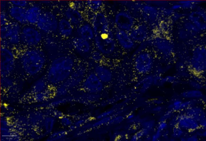 UBC Positive Control Multiomic Staining in Breast Cancer