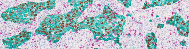 Chromogenic Stain of Human Tissue with ChromoPlex III and BOND RX