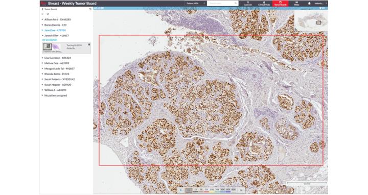 Multidisciplinary Team Meetings 