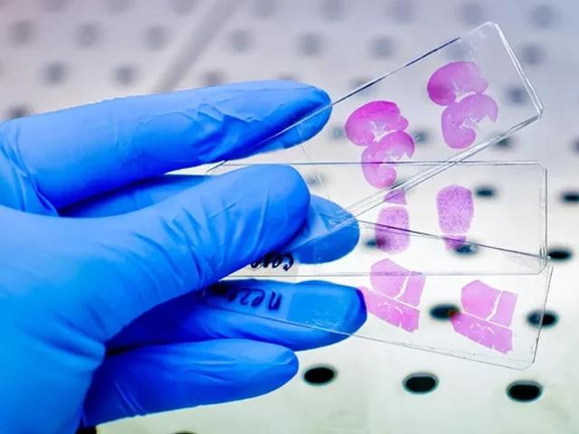 H-E-Staining-Overview-A-Guide-to-Best-Practices-640x480