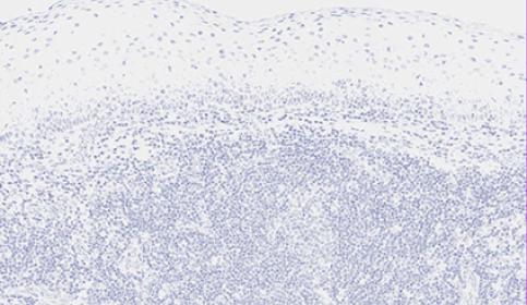Hematoxylin-counterstain
