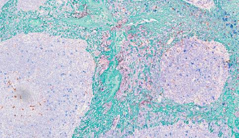 Multiplex Staining - 4 PLEX