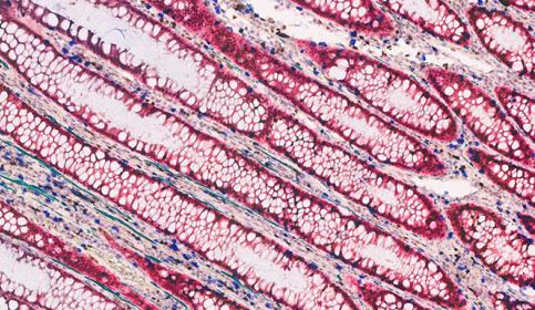 Multiplex Staining 5-Plex