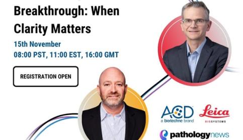 The-RNAscope-ISH-Breakthrough-When-Clarity-Matters