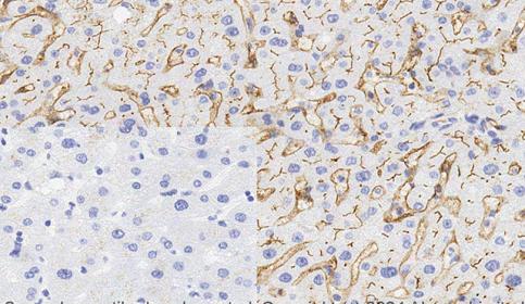 Histology slide stain using BOND RX and abcam Rabbit Monoclonal Anti-CD73 antibody