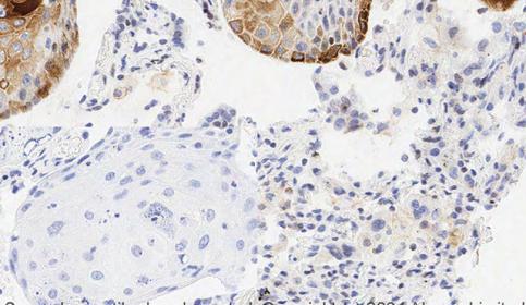 Histology slide stain using BOND RX and abcam Rabbit Monoclonal Anti-CXCR4 antibody