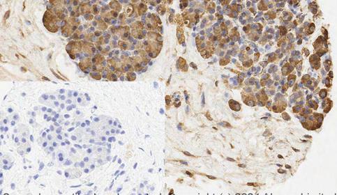 Histology slide stain using BOND RX and abcam Rabbit Monoclonal Anti-Calreticulin antibody