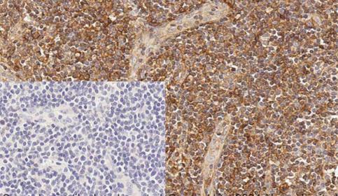 Histology slide stain using BOND RX and abcam Rabbit Monoclonal Anti-HLA A antibody