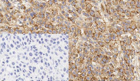 Histology slide stain using BOND RX and abcam Rabbit Monoclonal Anti-Met antibody