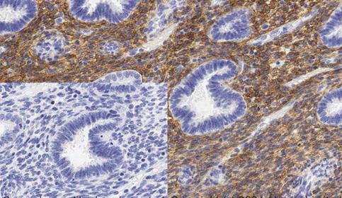 Histology slide stain using BOND RX and abcam Rabbit Monoclonal Anti-PDGFR alpha antibody