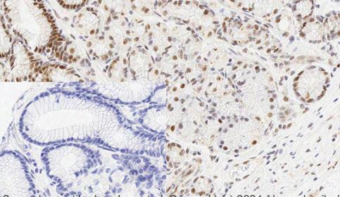 Histology slide stain using BOND RX and abcam Rabbit Monoclonal Anti-Smad3 antibody
