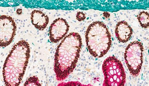 Chromogenic Stain of Colon Tissue with ChromoPlex III and BOND RX
