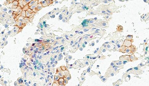 Chromogenic Stain of Lung Tissue with ChromoPlex III and BOND RX